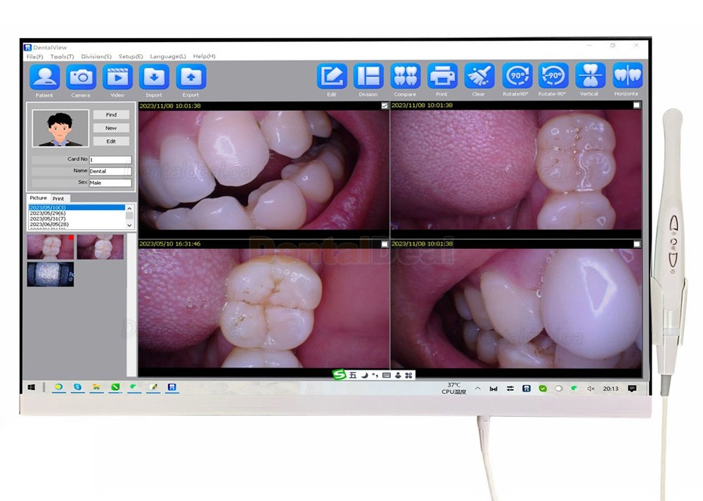 Magenta YF-2400P 24 Inch Touch Screen Intraoral Camera with WIFI